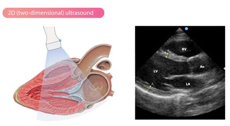 2d echo with doppler|2 d echocardiogram cpt code.